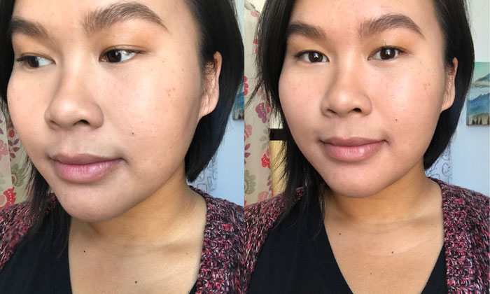 4 Products For Acne Scars That Smooth Skin Texture