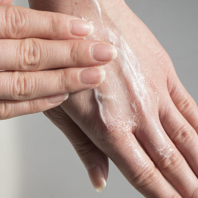 how to get rid of cracked hands
