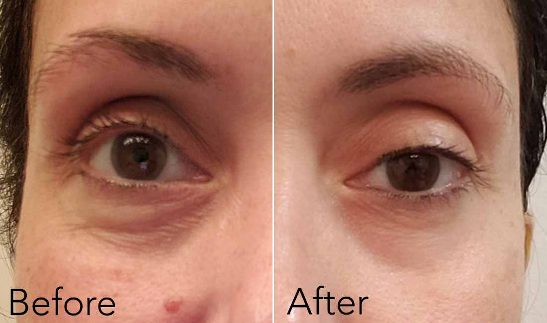The Peptide-Packed Fermentation Eye Cream That Made One Woman's Eyes Look  More Youthful and Less Tired in Two Weeks (Before & After Photos)