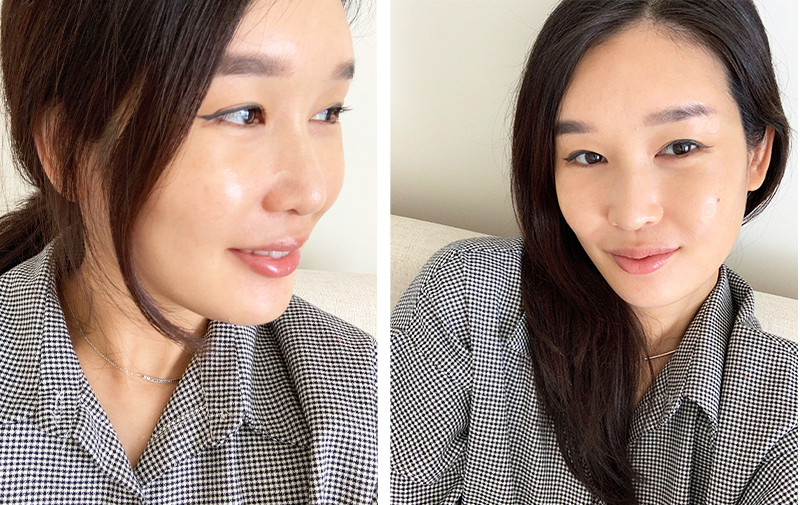 Charlotte Cho with Soft Shield Pimple Patches on Face